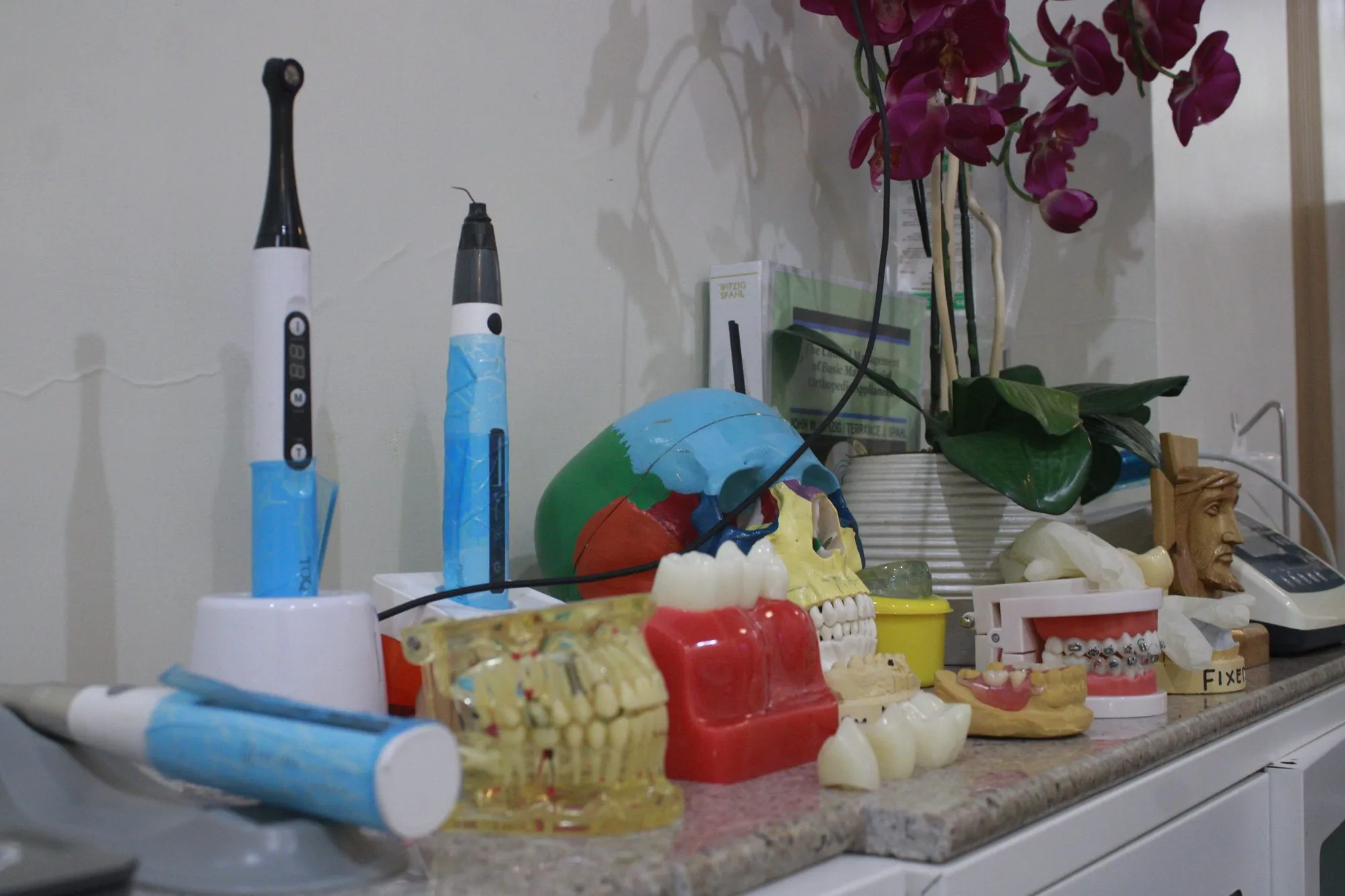 Orthodontic study models with fixed braces used to plan treatment at iDent Dental Lounge, Cagayan de Oro